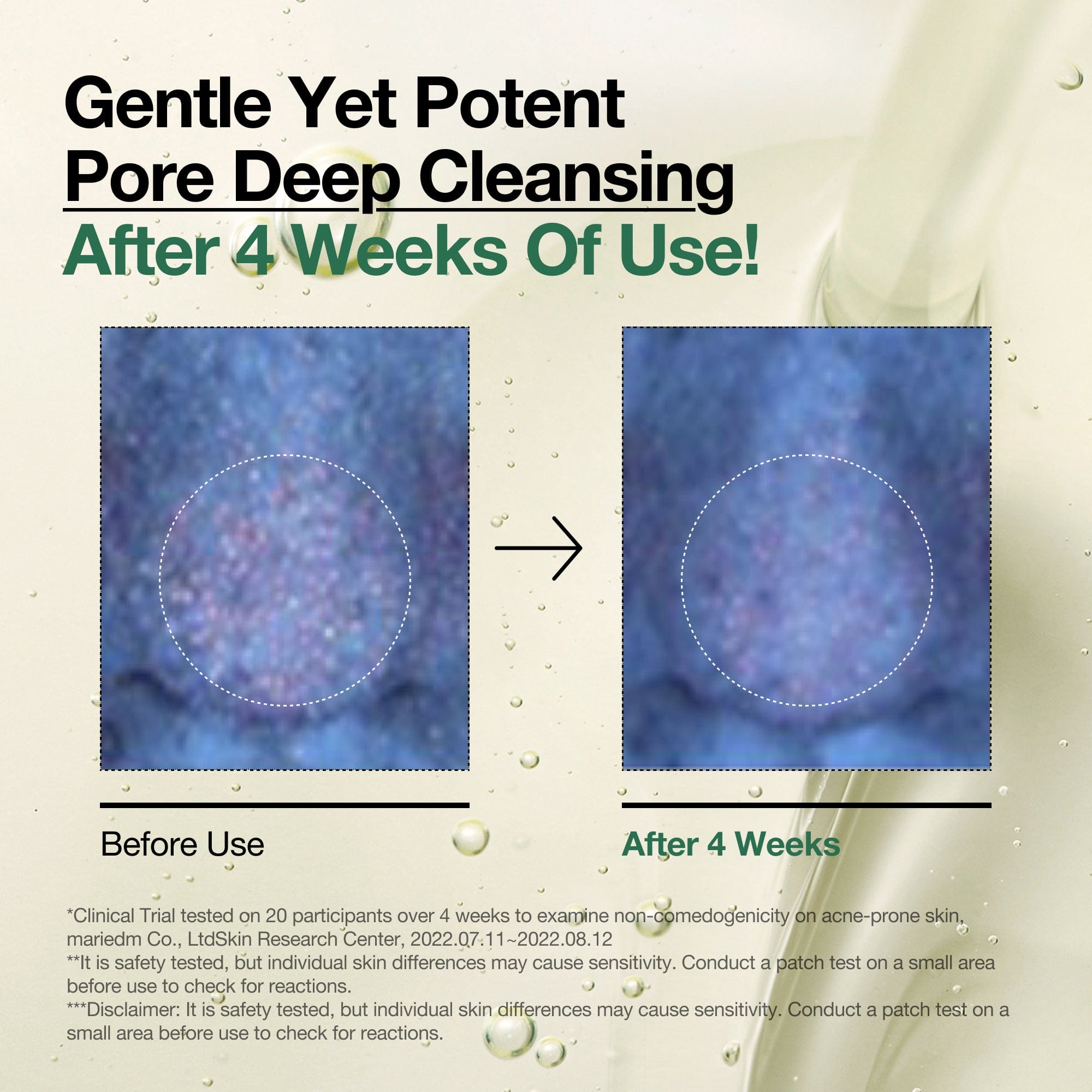 Anua Global Cleanser 200ml Heartleaf Pore Control Cleansing Oil
