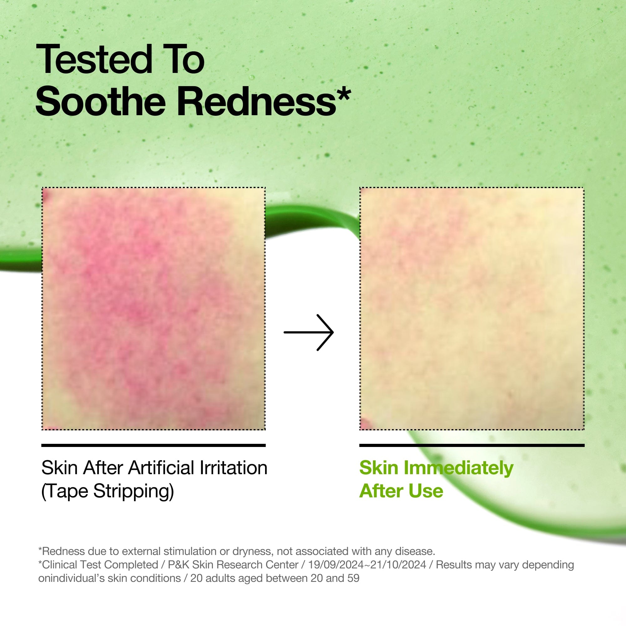 Anua US Ampoule/Serum Azelaic Acid 10 Hyaluron Redness Soothing Serum