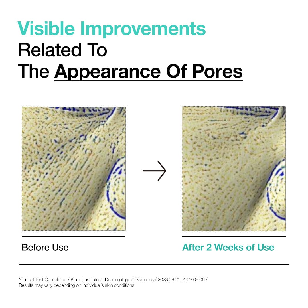 Anua US Toner 150ml BHA 2% Gentle Exfoliating Toner